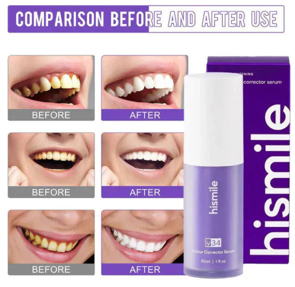 30ml V34 Whitening Toothpaste showing whitening formula for teeth and gum care